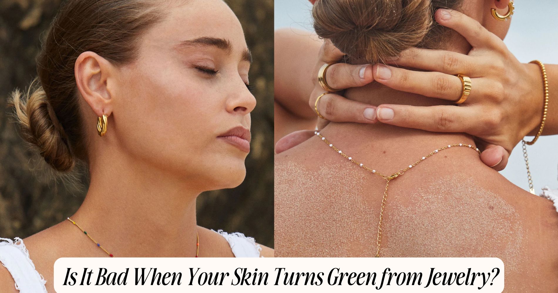 is it bad when your skin turns green from jewelry